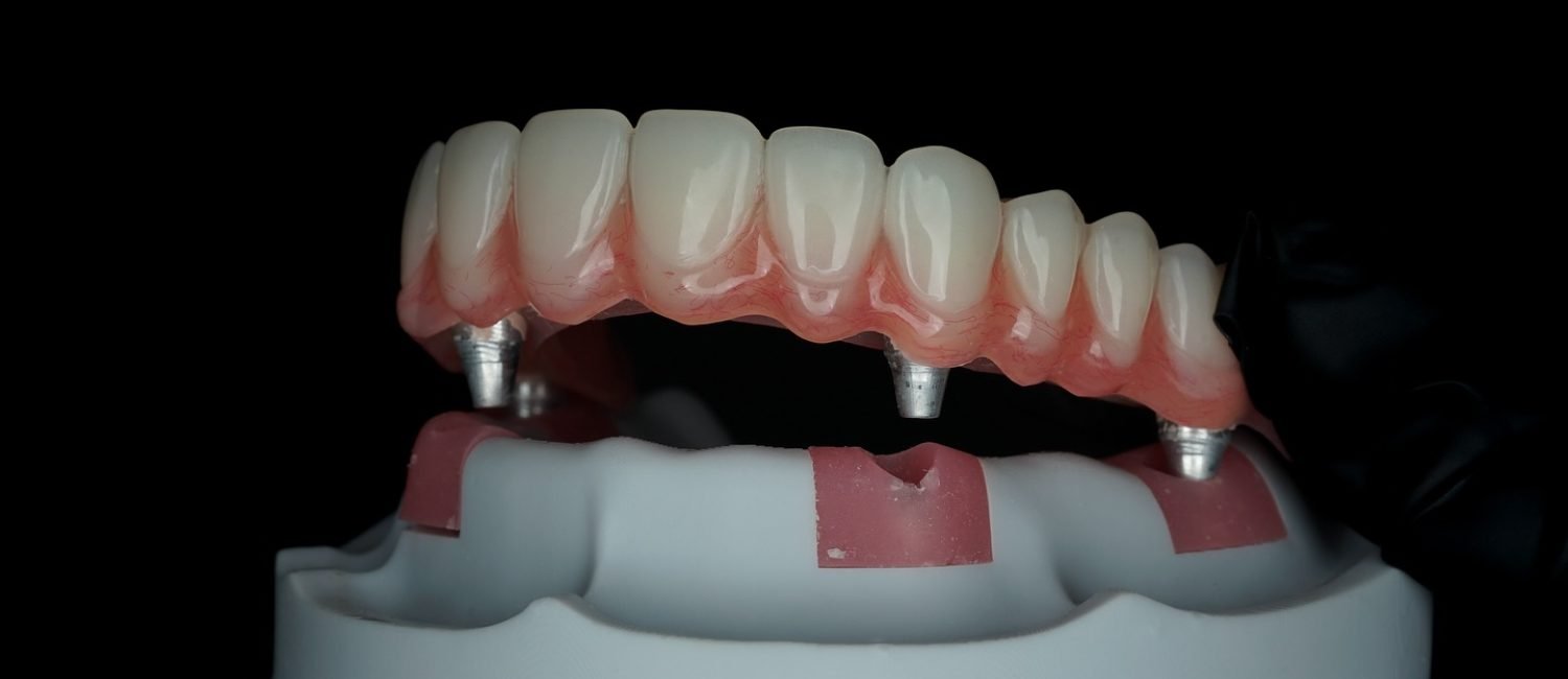 459956116_18458018095051135_996343824682377162_n